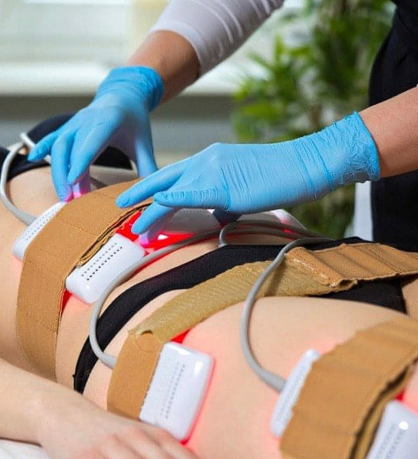 Laser Liposuction - Non-Surgical