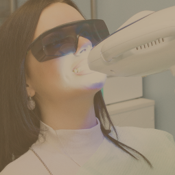 Teeth Whitening