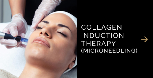 Collagen Microneedling