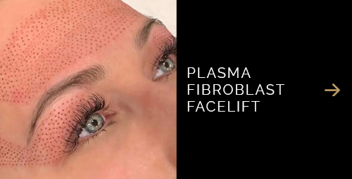 Plasma Fibroblast Facelift